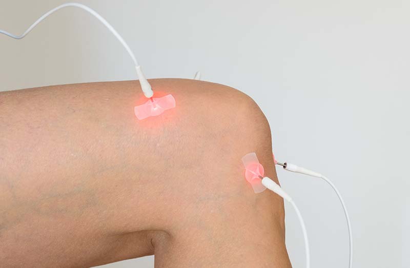 laserbehandlung Dr. med. Andrea Biechteler